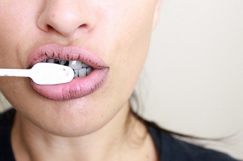 Có nên làm trắng răng tại nhà?