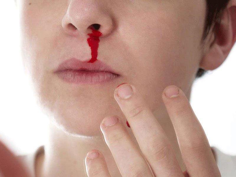 Nữ giới sốt xuất huyết, chảy máu cam có ảnh hưởng gì?
