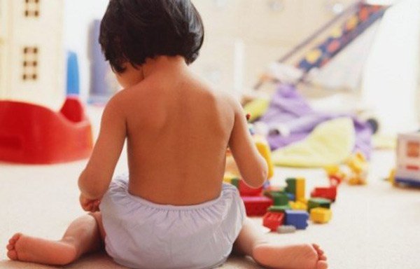 Trẻ bị dính 2 môi âm đạo có ảnh hưởng gì không?