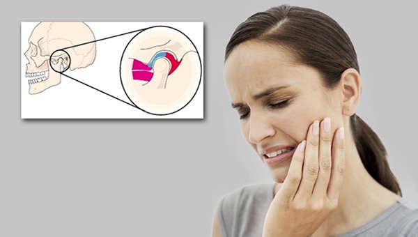 Cảnh giác khi bị đau quai hàm gần tai