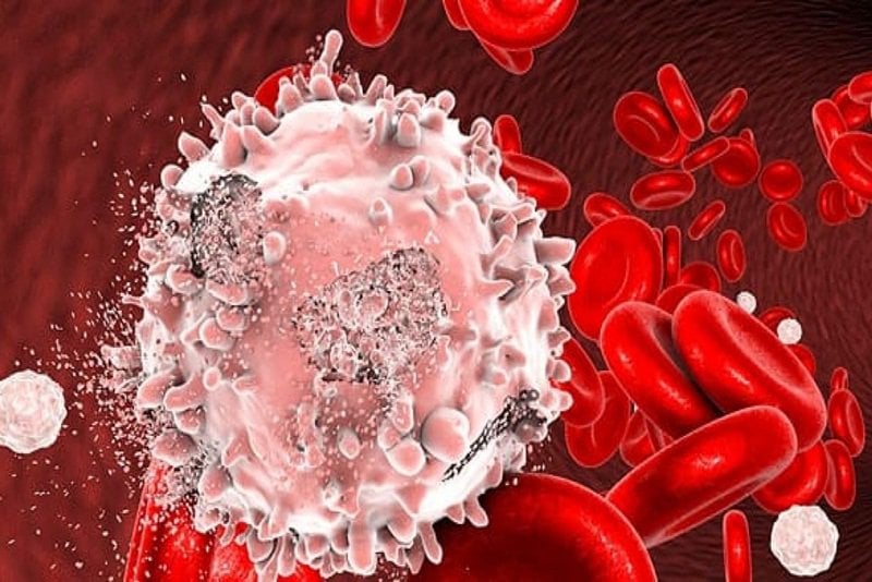 Người ung thư máu giảm bạch cầu đột ngột sau khi hóa trị có sao không?