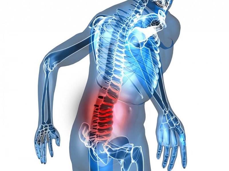Điều trị dứt điểm đau lưng do xẹp đốt sống như thế nào?