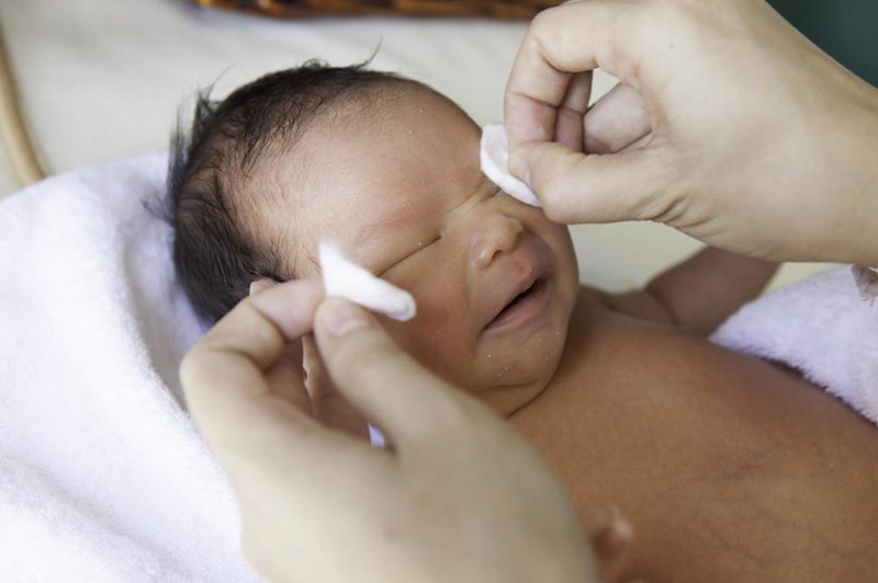 Trẻ sơ sinh có nhiều gỉ mắt có sao không?