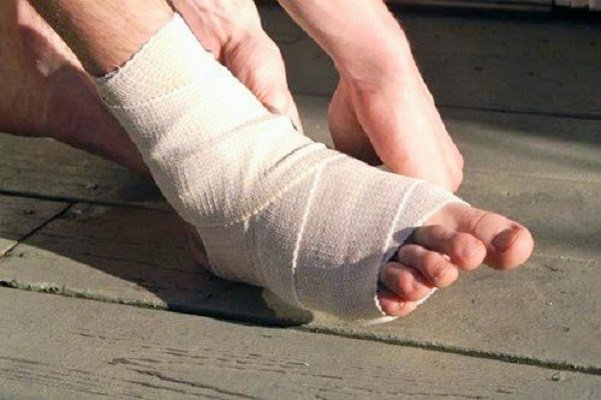Bị tê cứng bàn chân sau gãy xương mu phải làm sau?