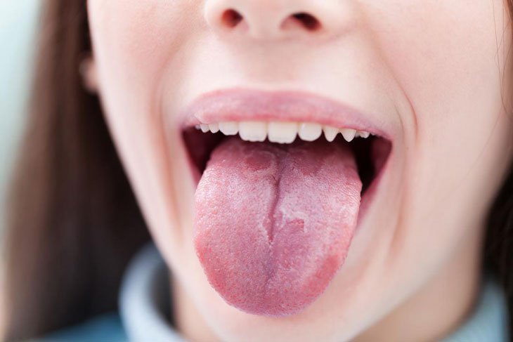 Lưỡi và tạng tâm trong đông y có mỗi liên quan mật thiết với nhau