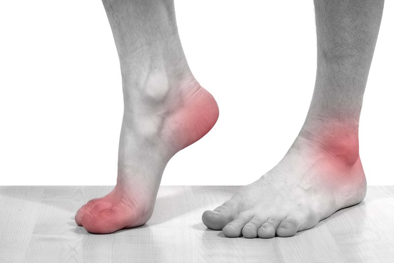 bệnh gout đau gót chân