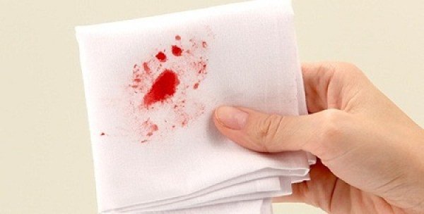 Nam giới khạc ra máu khi đánh răng nguyên nhân là gì?