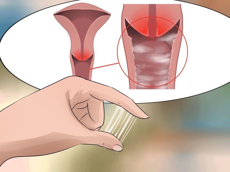 Nữ giới tăng tiết dịch âm đạo nguyên nhân là gì?
