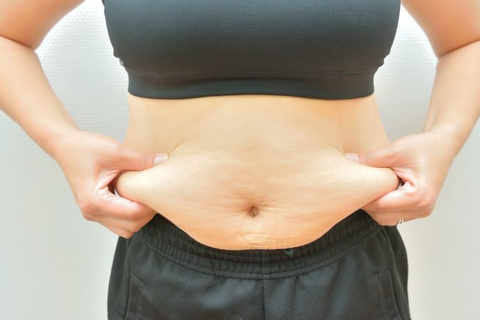 Da bụng sau hút mỡ bụng có khôi phục lại như ban đầu không?