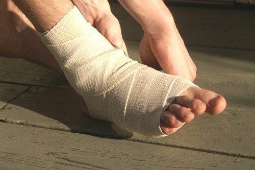 Nam giới đứt bán phần gân duỗi ngón chân sau phẫu thuật nên làm gì?