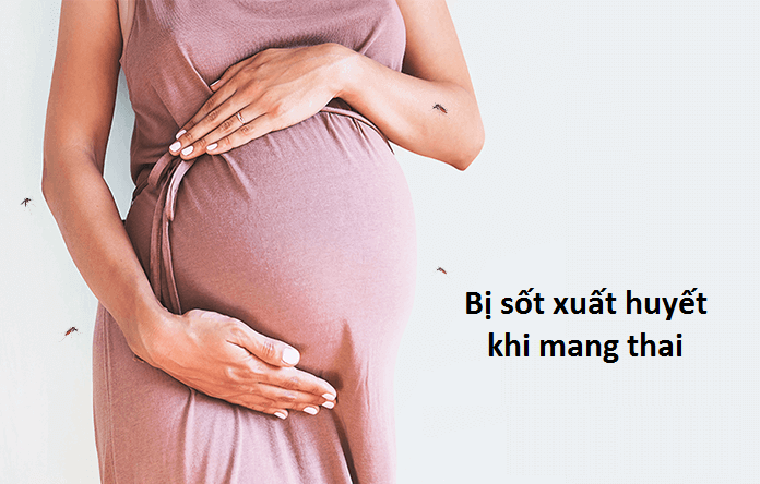 Phụ nữ mang thai mắc sốt xuất huyết