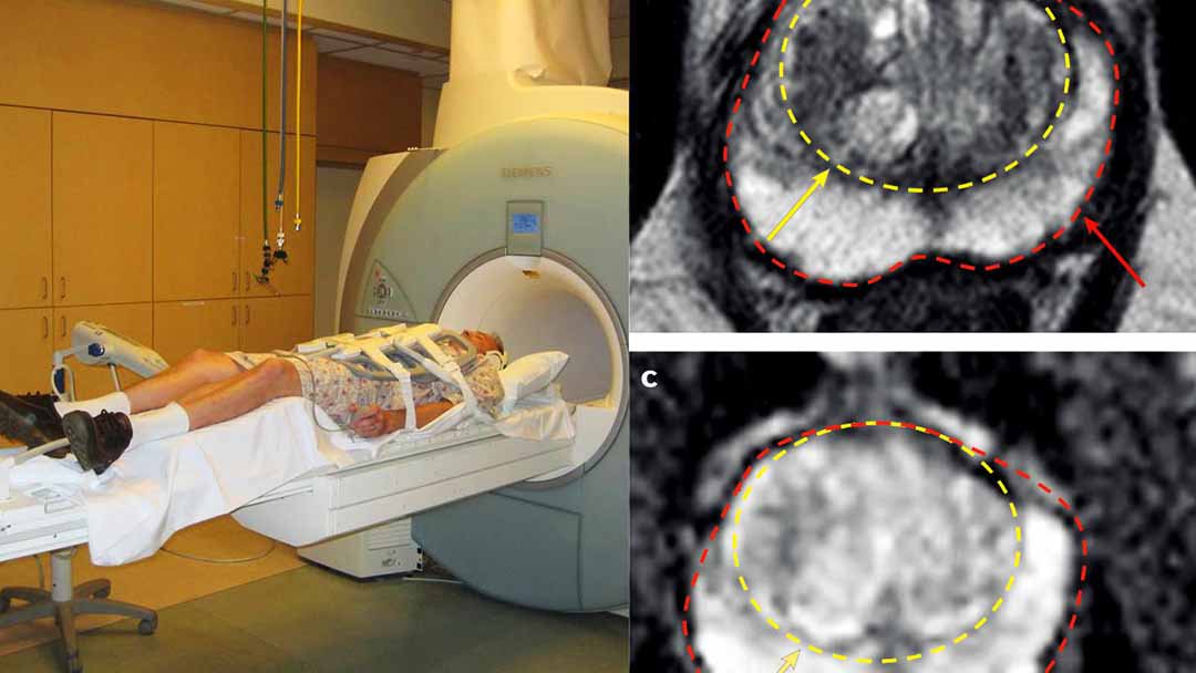 Một số xét nghiệm hình ảnh giúp bác sĩ đánh giá tình trạng ung thư của người bệnh