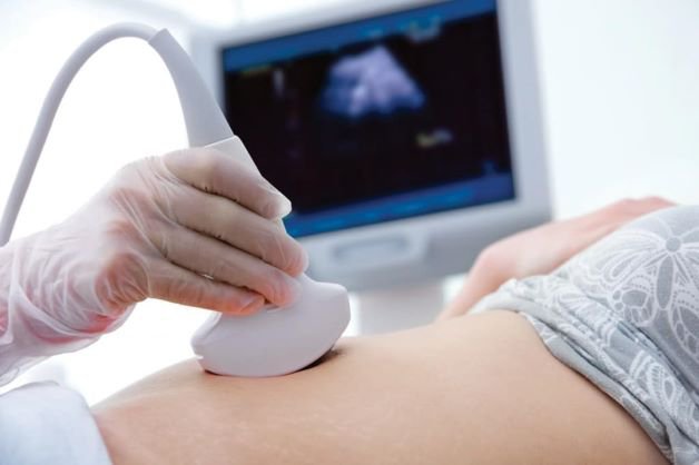 Mang thai đôi 6 tuần, một thai không có tim thai nguyên nhân là gì?
