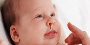 Trẻ 10 tháng tuổi chảy máu mũi là do đâu?