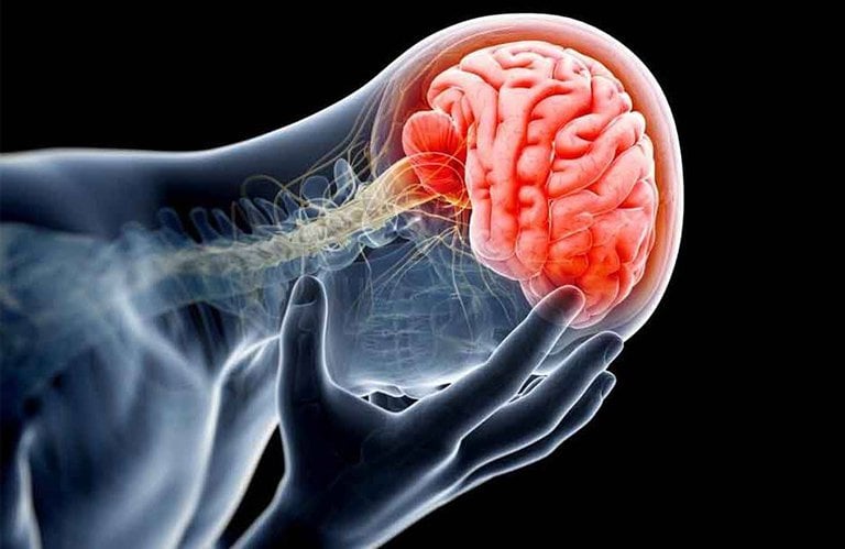 Phục hồi chức năng não bộ sau chấn thương sọ não
