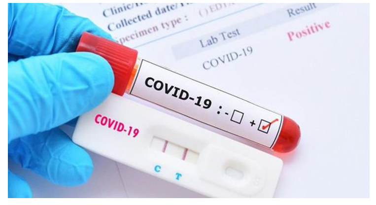 Chỉ số CT test PCR Covid lần 2 giảm do nguyên nhân gì?