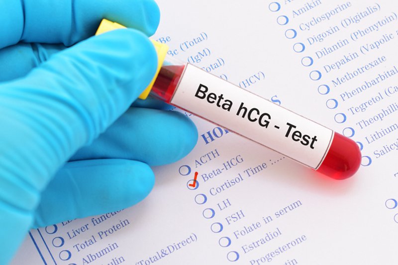 Trễ kinh kèm xét nghiệm HCG lớn hơn 6158 mU/mL là sao?