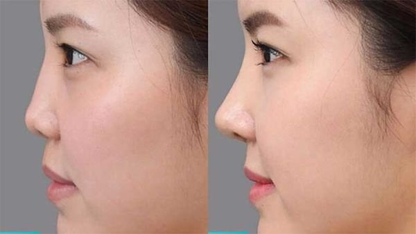 How I get rid of my double chin in seconds: 'Mewing' beauty trend