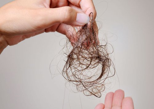 Rụng tóc nhiều là dấu hiệu cảnh báo cơ thể thiếu chất dinh dưỡng