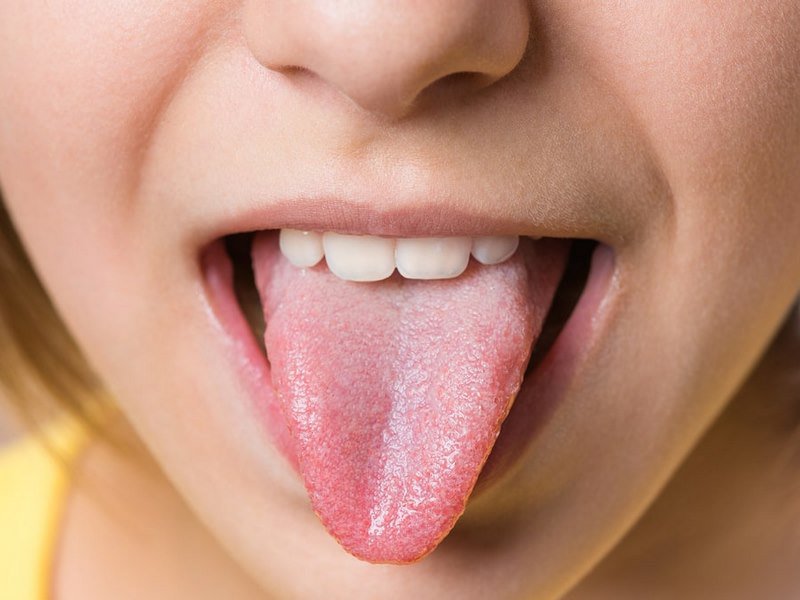 Lưỡi nói gì về sức khỏe của bạn