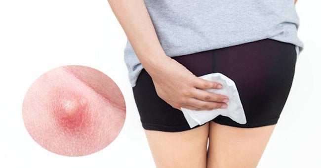 There is a lump on the inside of my outer labia, should I be concerned?  What is it? - Quora
