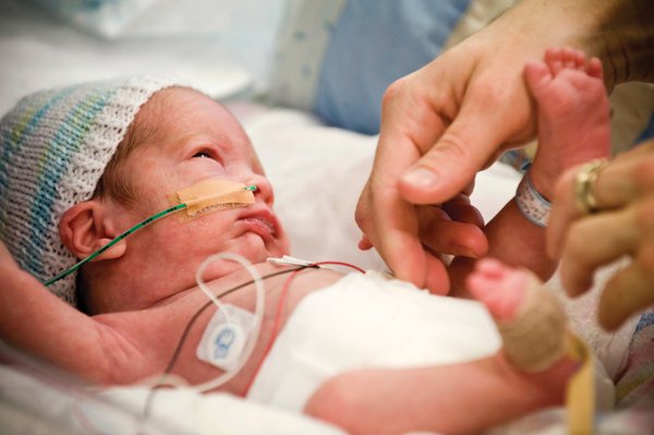 Sinh non trước 37 tuần là một trong các nguy cơ khiến trẻ sơ sinh bị vàng mắt