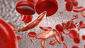 bệnh thiếu máu thalassemia