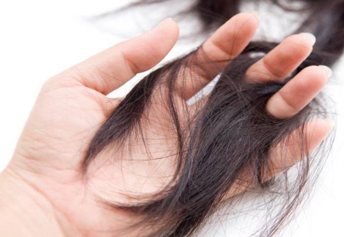 Nữ giới rụng tóc nhiều, chóng mặt nguyên nhân là gì?