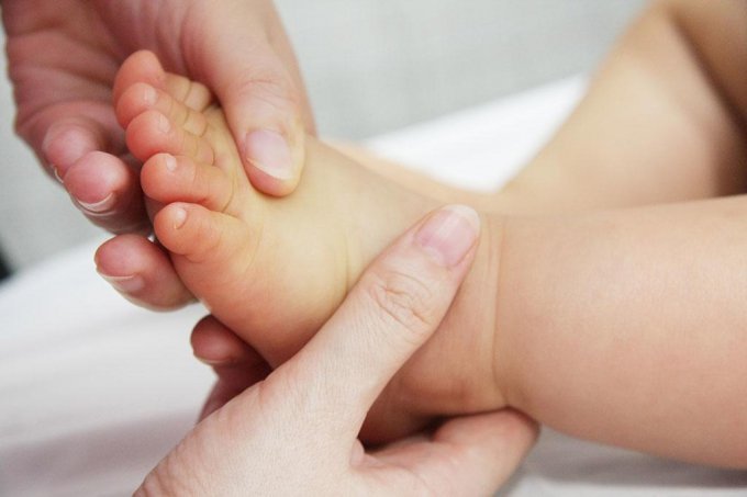 Trẻ 3 tháng tuổi vàng lòng bàn chân
