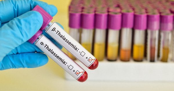 xét nghiệm gì để biết bệnh thalassemia