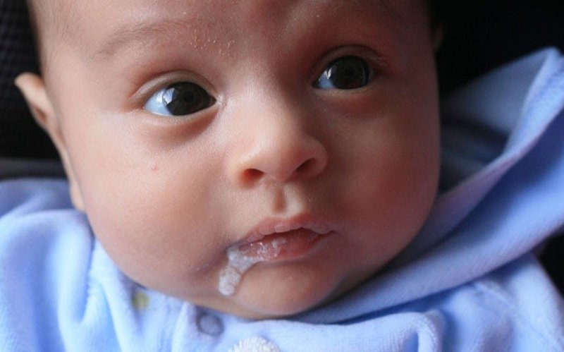 Trẻ sơ sinh nôn trớ sau bú do trào ngược dạ dày nguy hiểm không?