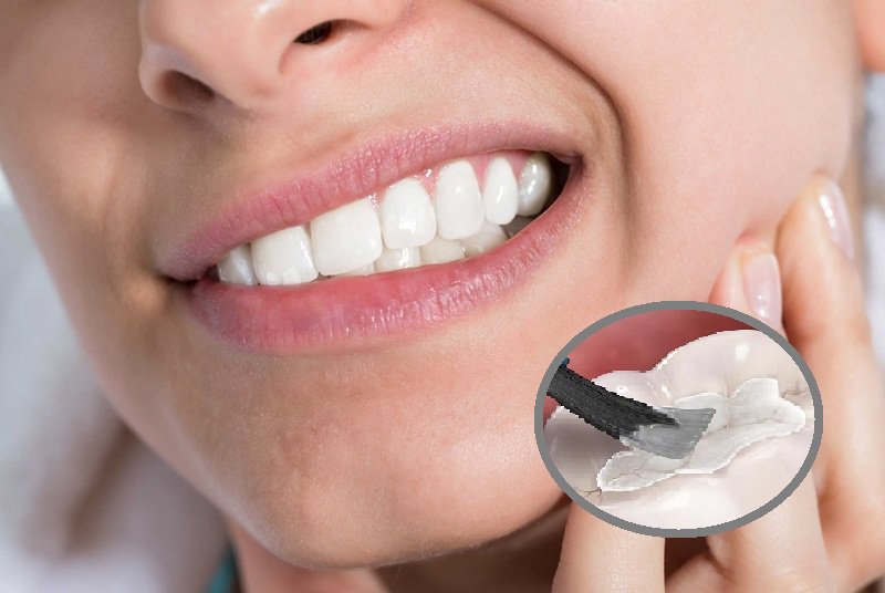 Đau nhức răng sau khi trám răng hàm