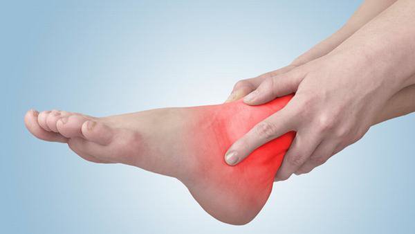 Chân sưng đau kèm bầm tím sau khi chấn thương bàn chân nên làm gì?