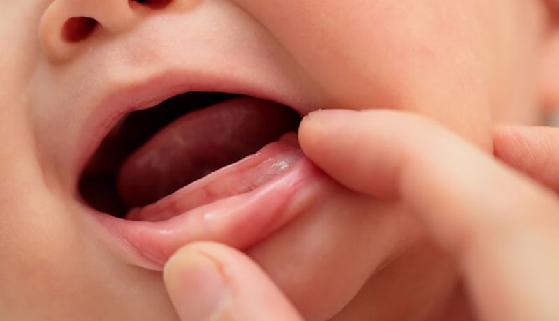Trẻ 11 tháng tuổi chưa mọc răng