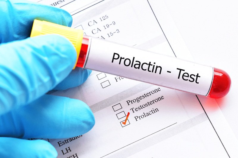 Xét nghiệm prolactin