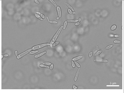 hinh-anh-nam-candida-soi-tuoi (4).png