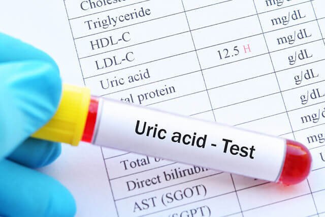 nồng độ acid uric trong máu cao