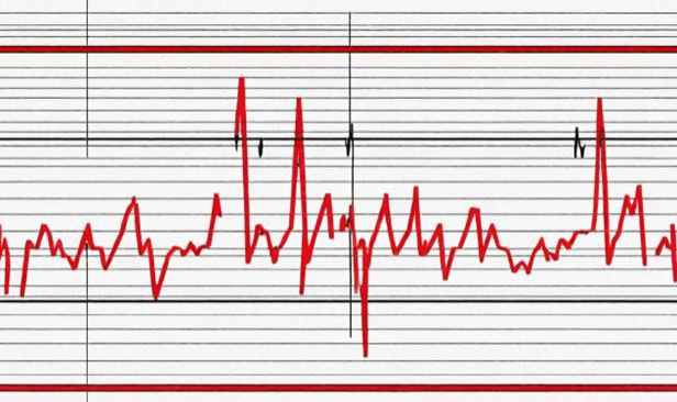 Mối liên hệ giữa nhịp tim và huyết áp là gì?