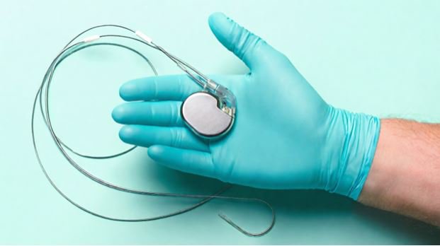 Máy ghi vòng lặp cấy ghép là một thiết bị theo dõi nhịp tim nhỏ gọn được cấy dưới da ở vùng ngực