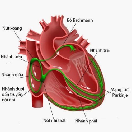 Understanding Right Bundle Branch Block 