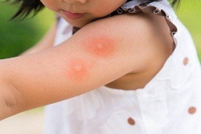 Why do children often get bitten by mosquitoes?