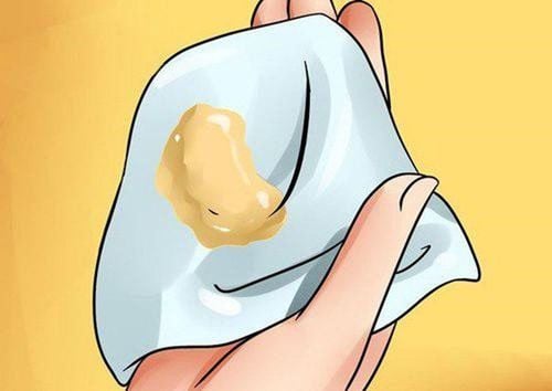 Âm đạo ra dịch nâu kèm đau bụng sau sinh mổ có đáng lo không?