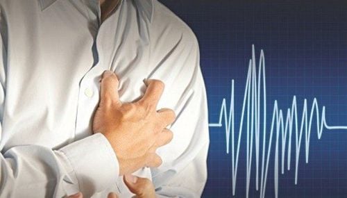  Cardiac Neurosis: What You Need to Know