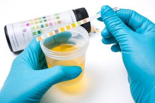 Yellow urine in newborns