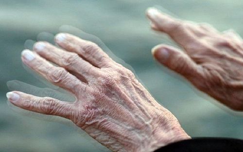 Khám bệnh Parkinson ở đâu Cần Thơ? 