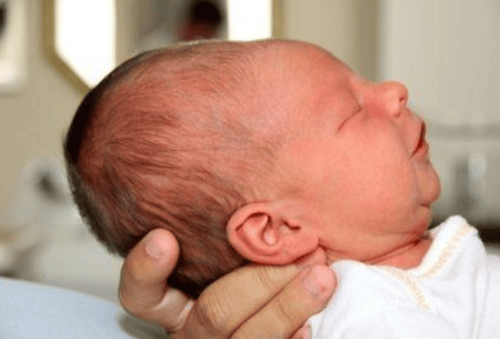 Long and flat head in newborns