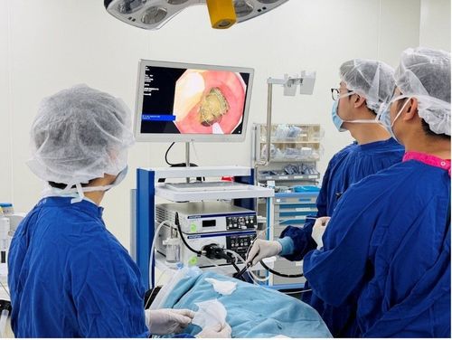 Người đàn ông bị khối dị vật từ măng khô chiếm gần trọn dạ dày