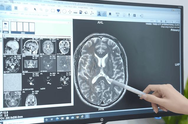 Trung tâm Thần kinh - Bệnh viện Đa khoa Quốc tế Vinmec Times City