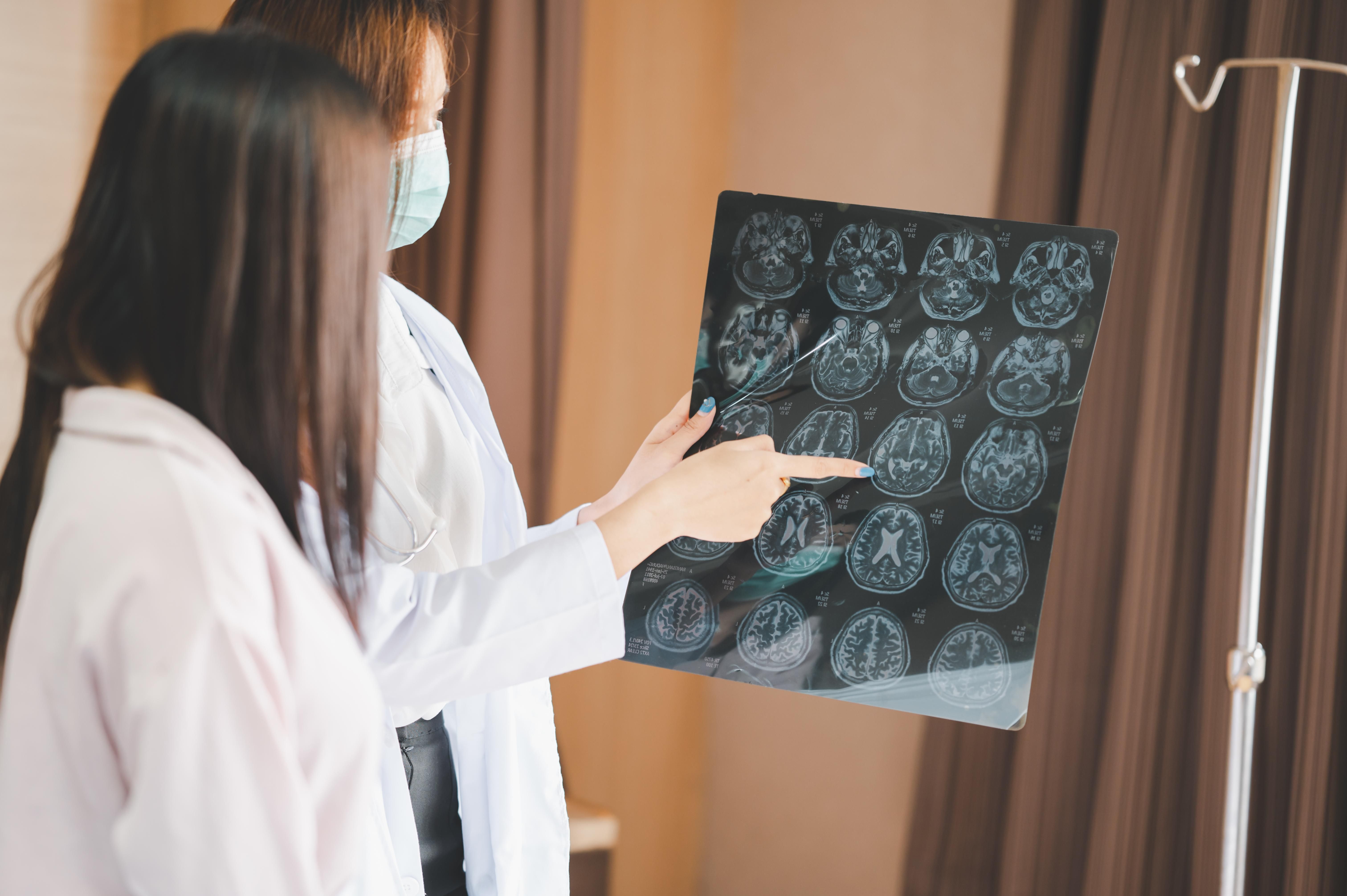 Chuyên khoa Nội Thần kinh - Đột quỵ - Bệnh viện Đa khoa Quốc tế Vinmec Times City