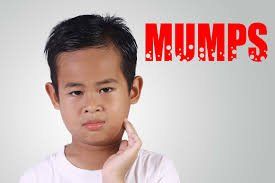 Nhấn vào ảnh để phóng to
Bệnh quai bị chưa có thuốc điều trị đặc hiệu, chủ yếu vẫn là điều trị hỗ trợ